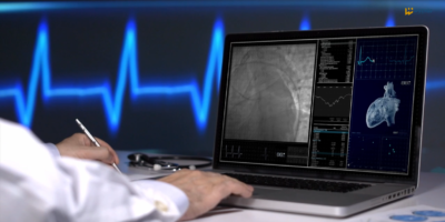 Koordynowana opieka i badania serca w siedleckim SPZOZ